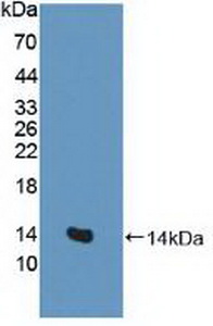 Polyclonal Antibody to Excitatory Amino Acid Transporter 3 (EAAT3)