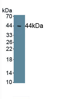 Polyclonal Antibody to Excitatory Amino Acid Transporter 2 (EAAT2)