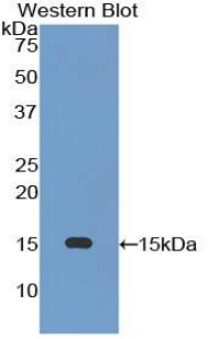 Polyclonal Antibody to Glucose Transporter 14 (GLUT14)