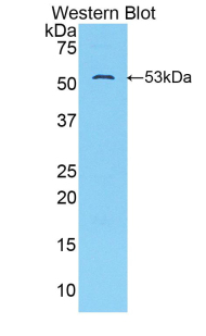 Polyclonal Antibody to Glucose Transporter 14 (GLUT14)