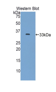 Polyclonal Antibody to Anion/Sugar Transporter (AST)