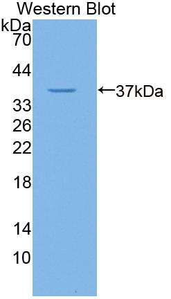 Polyclonal Antibody to Gibbon Ape Leukemia Virus Receptor 1 (GLVR1)