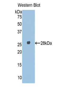 Polyclonal Antibody to Alpha-1-B-Glycoprotein (a1BG)