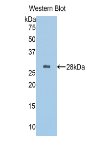 Polyclonal Antibody to Alpha-1-B-Glycoprotein (a1BG)