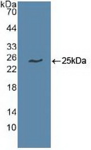 Polyclonal Antibody to Ubiquitin Conjugating Enzyme E2C (UBE2C)