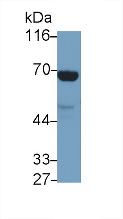 Polyclonal Antibody to Guanylate Binding Protein 1, Interferon Inducible (GBP1)