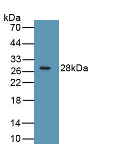 Polyclonal Antibody to Receptor Interacting Serine Threonine Kinase 3 (RIPK3)