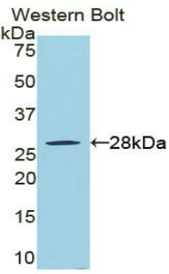 Polyclonal Antibody to Receptor Interacting Serine Threonine Kinase 3 (RIPK3)