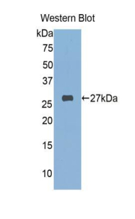Polyclonal Antibody to FK506 Binding Protein 3 (FKBP3)