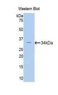 Polyclonal Antibody to Fascin 2 (FSCN2)