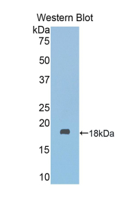 Polyclonal Antibody to Fascin 2 (FSCN2)