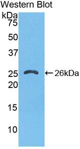 Polyclonal Antibody to FK506 Binding Protein 8 (FKBP8)