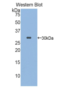 Polyclonal Antibody to FK506 Binding Protein 10 (FKBP10)