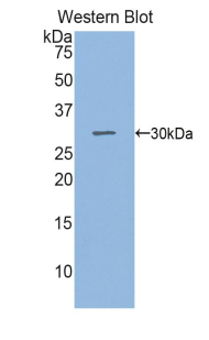 Polyclonal Antibody to Sphingosine 1 Phosphate Lyase 1 (SGPL1)