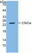 Polyclonal Antibody to Sphingosine 1 Phosphate Lyase 1 (SGPL1)