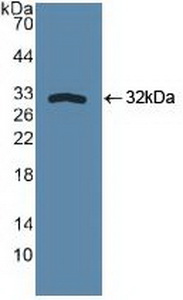 Polyclonal Antibody to Sphingosine Kinase 1 (SPHK1)