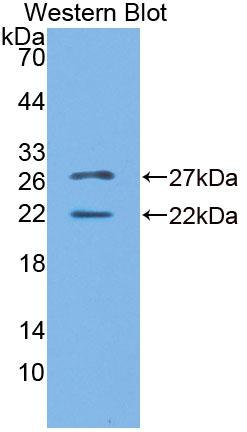 Polyclonal Antibody to Sphingosine Kinase 2 (SPHK2)