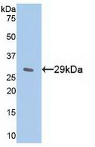 Polyclonal Antibody to Inhibitory Subunit Of NF Kappa B Epsilon (IkBe)