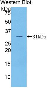Polyclonal Antibody to Tubulin Epsilon (TUBe)