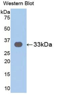 Polyclonal Antibody to Interleukin 31 Receptor A (IL31RA)