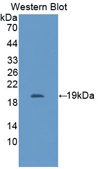 Polyclonal Antibody to Interleukin 11 Receptor Alpha (IL11Ra)