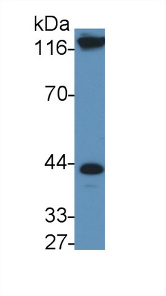 Polyclonal Antibody to Interleukin 11 Receptor Alpha (IL11Ra)