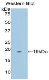 Polyclonal Antibody to Annexin A4 (ANXA4)