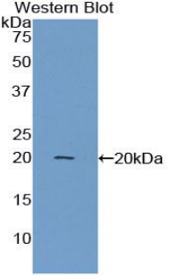 Polyclonal Antibody to Annexin A4 (ANXA4)