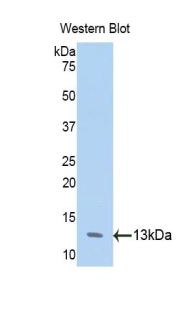 Polyclonal Antibody to Annexin A4 (ANXA4)