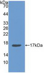 Polyclonal Antibody to Annexin A3 (ANXA3)