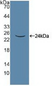 Polyclonal Antibody to Pannexin 1 (PANX1)