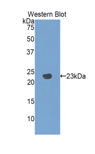 Polyclonal Antibody to Pannexin 1 (PANX1)