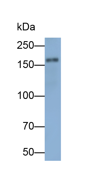 Polyclonal Antibody to Nuclear Receptor Coactivator 3 (NCOA3)