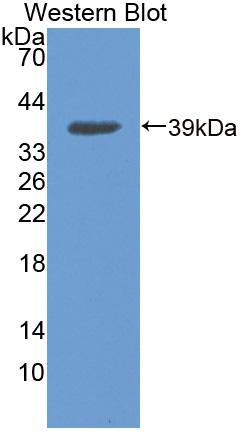 Polyclonal Antibody to Nuclear Receptor Coactivator 3 (NCOA3)