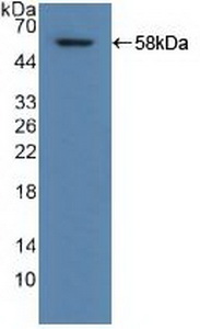 Polyclonal Antibody to Aldehyde Dehydrogenase 1 Family, Member A1 (ALDH1A1)