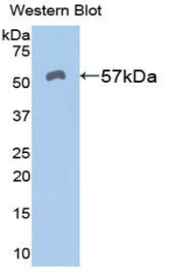 Polyclonal Antibody to Aldehyde Dehydrogenase 7 Family, Member A1 (ALDH7A1)