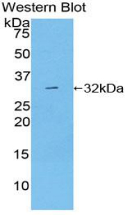 Polyclonal Antibody to Diacylglycerol Kinase Gamma (DGKg)