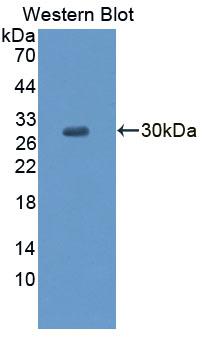 Polyclonal Antibody to Glycine Receptor Alpha 2 (GLRa2)