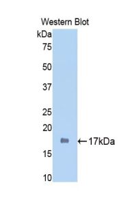 Polyclonal Antibody to Sirtuin 7 (SIRT7)