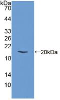 Polyclonal Antibody to Eukaryotic Translation Initiation Factor 2 Alpha Kinase 3 (EIF2aK3)