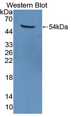 Polyclonal Antibody to Eukaryotic Translation Elongation Factor 1 Gamma (EEF1g)