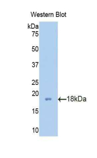 Polyclonal Antibody to Profilin 2 (PFN2)