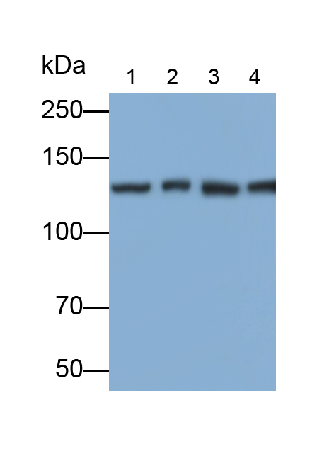 Polyclonal Antibody to Ubiquitin Specific Peptidase 8 (USP8)