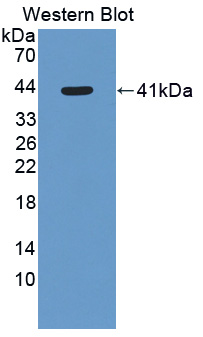 Polyclonal Antibody to 11-Beta-Hydroxysteroid Dehydrogenase Type 2 (HSD11b2)