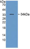 Polyclonal Antibody to Anthrax Toxin Receptor 2 (ANTXR2)