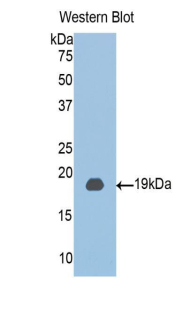 Polyclonal Antibody to Chloride Intracellular Channel Protein 4 (CLIC4)