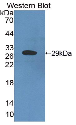 Polyclonal Antibody to Cysteine Rich Secretory Protein 2 (CRISP2)