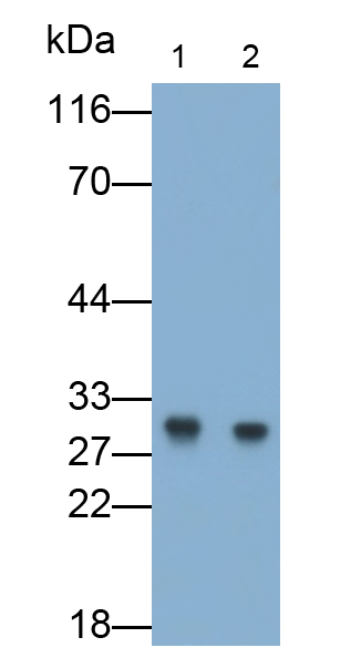 Polyclonal Antibody to Crystallin Beta B1 (CRYbB1)