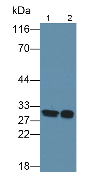 Polyclonal Antibody to Crystallin Beta B2 (CRYbB2)