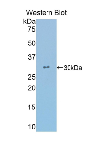 Polyclonal Antibody to Crystallin Lambda 1 (CRYl1)